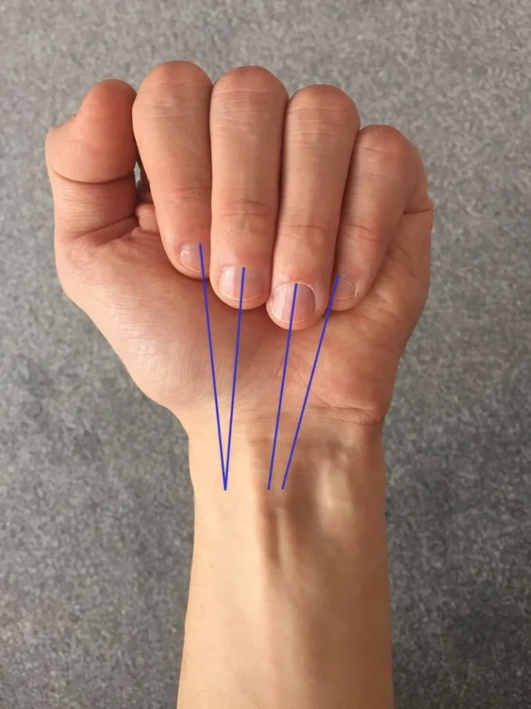 طبیعی است که انگشتان شما تقریباً به سمت استخوان های اسکافوئید و ماهری در دست شما اشاره می کنند.